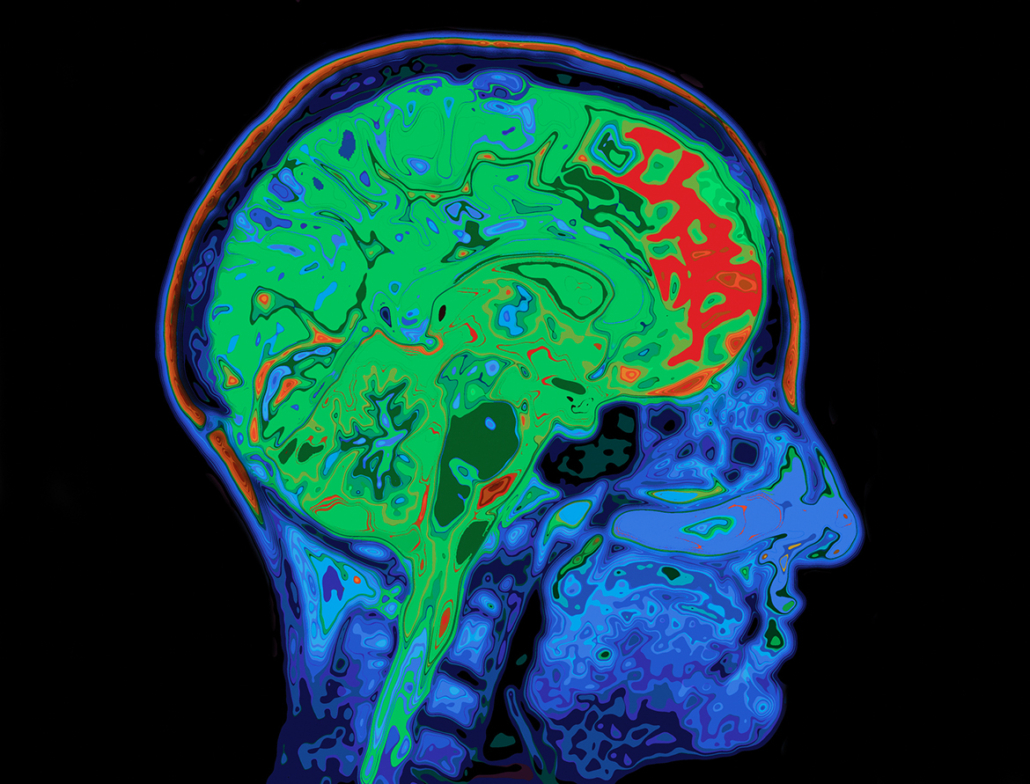 Brain